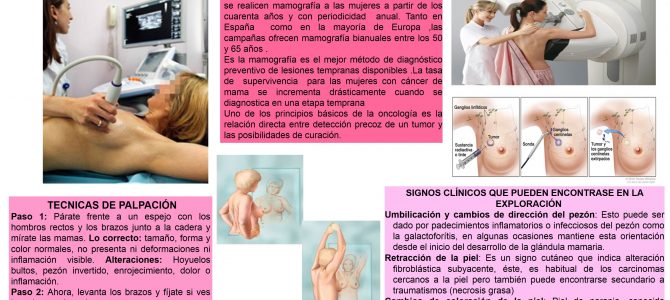 “Día Mundial del Cáncer de mama”, por Lucía García.